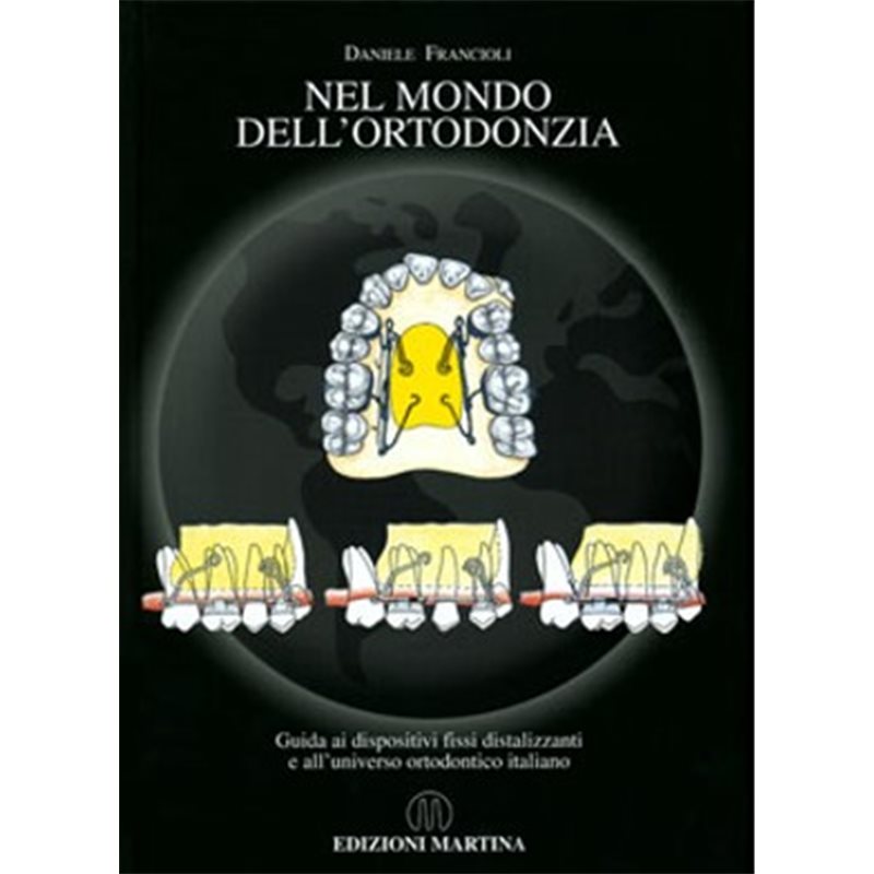 NEL MONDO DELL' ORTODONZIA - Guida ai dispositivi fissi distalizzanti e all'universo ortodontico italiano
